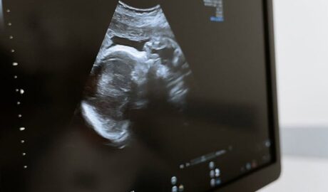dangers of ultrasound