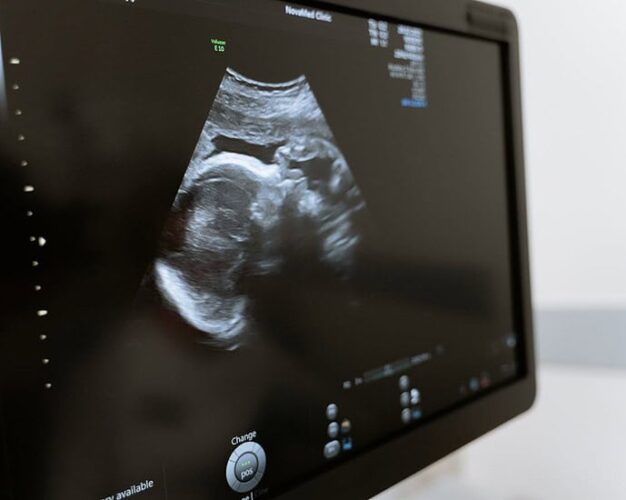 dangers of ultrasound