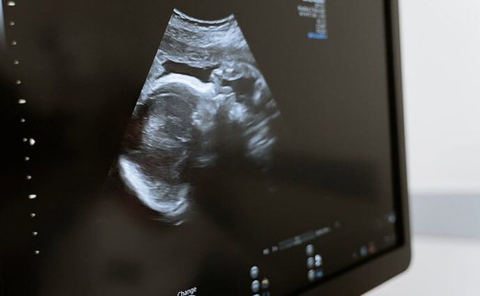 dangers of ultrasound